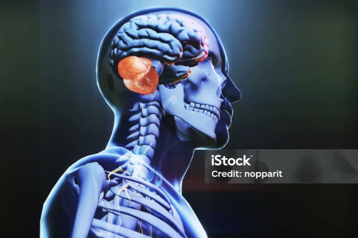 https://www.istockphoto
