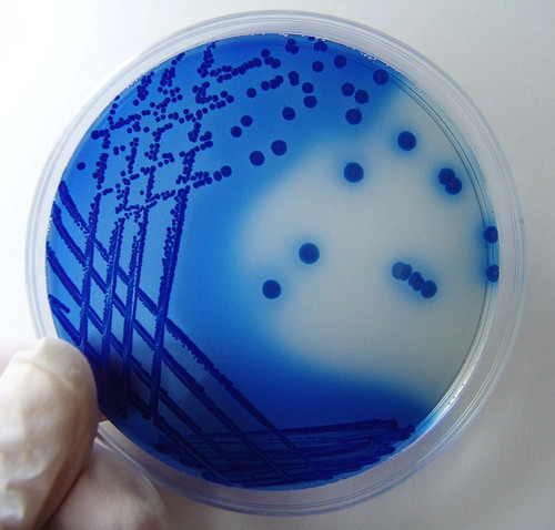 https://www.freeimages.com/search/bacilos-bacteria