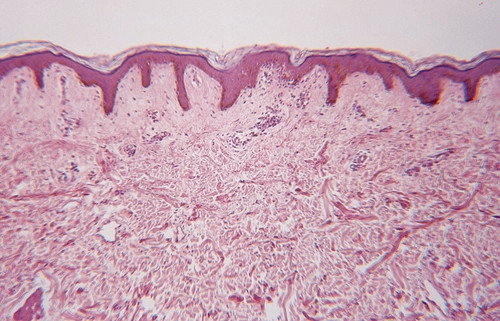 https://www.freeimages.com/search/epidermis
