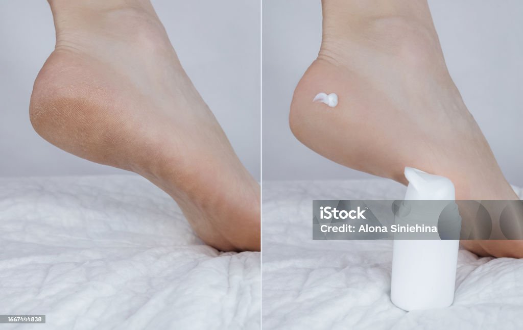 www.istockphoto.com
